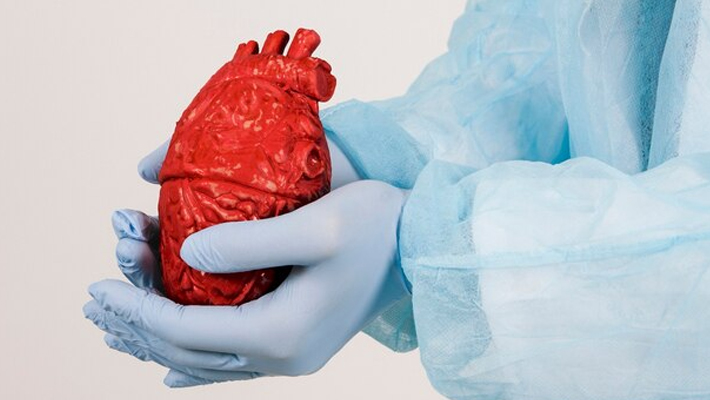 Coronary Artery Bypass Grafting